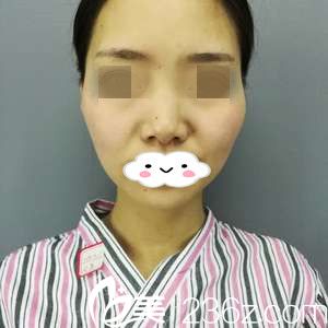 手术前的我 手术前的我