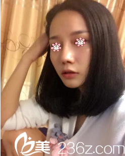 重庆美仑美奂姬广翰隆鼻好吗 重庆美仑美奂姬广翰隆鼻好吗