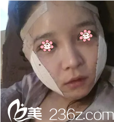 金寿信院长给我做完手术后第三天 金寿信院长给我做完手术后第三天