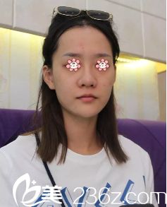 之前我做失败的鼻子 之前我做失败的鼻子