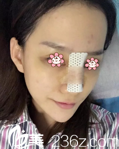 修复术后第五天 修复术后第五天