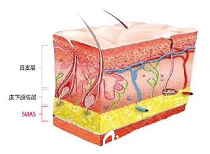 面部提升图解 面部提升图解