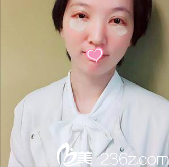 在北京美莱做韩式双眼皮开眼角祛眼袋术后即刻样子 在北京美莱做韩式双眼皮开眼角祛眼袋术后即刻样子