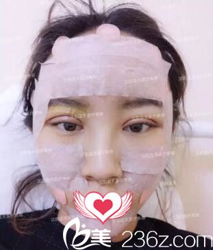 双眼皮+自体脂肪填充全脸术后即刻效果 双眼皮+自体脂肪填充全脸术后即刻效果