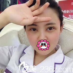 3D媚眼综合术术后一周恢复效果 3D媚眼综合术术后一周恢复效果