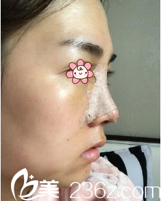 郑镐勋院长给我做完手术后第六天 郑镐勋院长给我做完手术后第六天