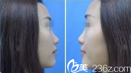 手术前的我 手术前的我