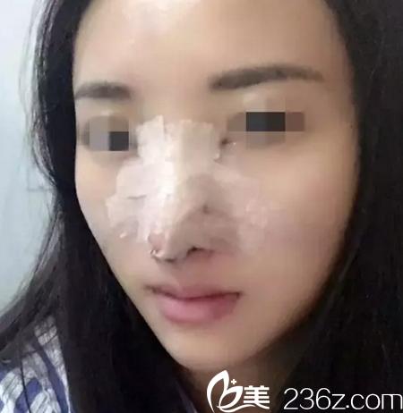 术后当天 术后当天