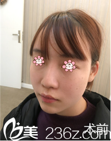 之前我做失败的鼻子 之前我做失败的鼻子