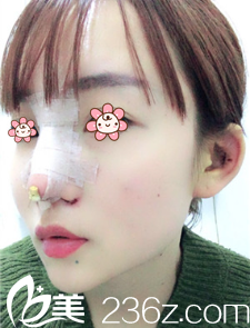 手术做完后第三天 手术做完后第三天