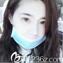 我的术前照 我的术前照