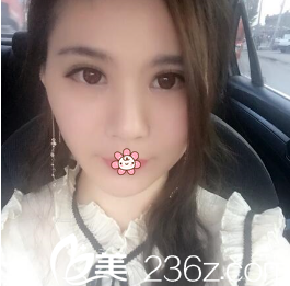 去年3月18号在韩国i-Line整形外科做的双眼皮+开眼角效果是我较满意的一次！