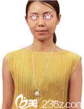 术前的我 术前的我