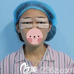 祛眼袋手术当天