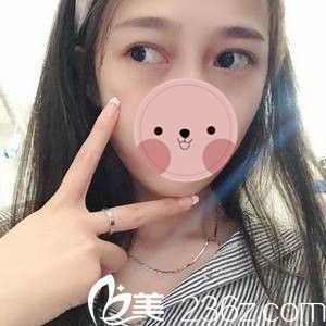 祛眼袋术后一周