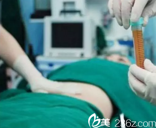 在北京壹加壹做吸脂手术使样子 在北京壹加壹做吸脂手术使样子