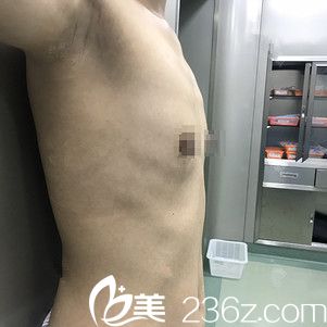 无锡坤如玛丽整形美容医院赵斌术前照片1