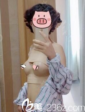 术后四天假体隆胸恢复中 术后四天假体隆胸恢复中