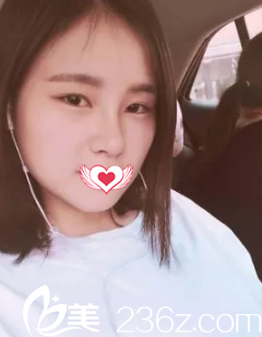 术后18天双眼皮、鼻子和面部都在慢慢恢复中 术后18天双眼皮、鼻子和面部都在慢慢恢复中