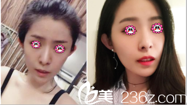 北京华韩谌燃案例 北京华韩谌燃案例