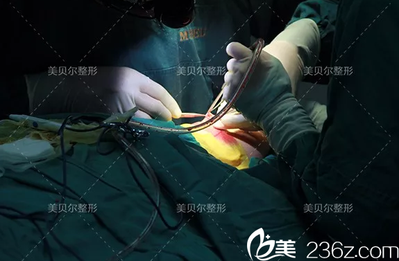 鼻综合整形手术中