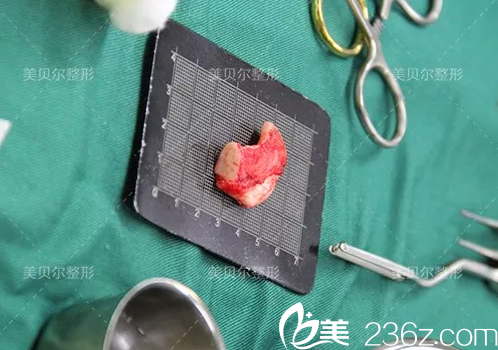 取出备用的肋软骨材料