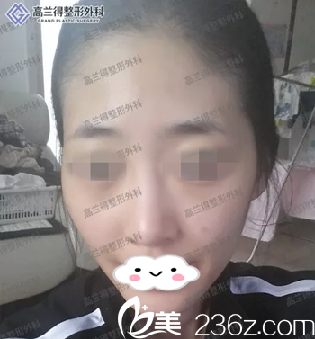 手术前的我 手术前的我