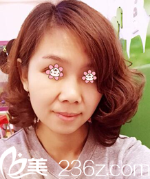 术前的我 术前的我