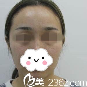 手术前的我 手术前的我