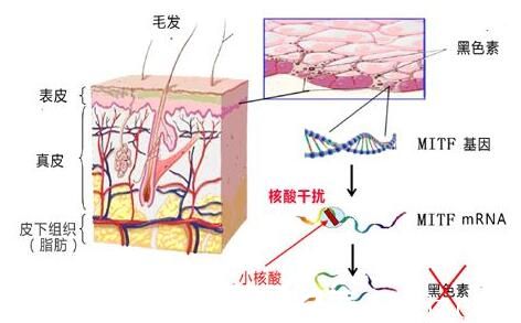 皮秒激光祛斑