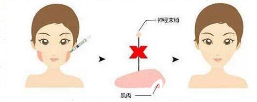 多钱一针
