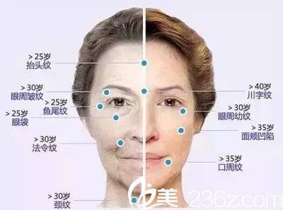 女性面部皱纹分类和出现时间段