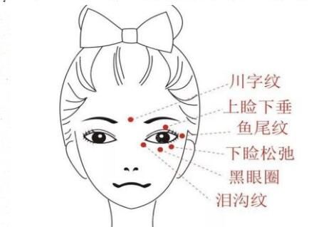 面部有那些皱纹问题