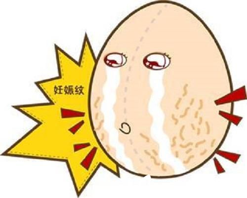 难看的妊娠纹很苦恼