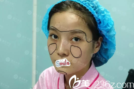术前的笑笑 术前的笑笑