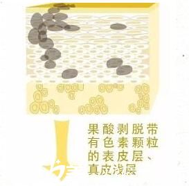 果酸换肤原理 果酸换肤原理