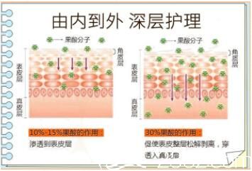 果酸换肤技术 果酸换肤技术