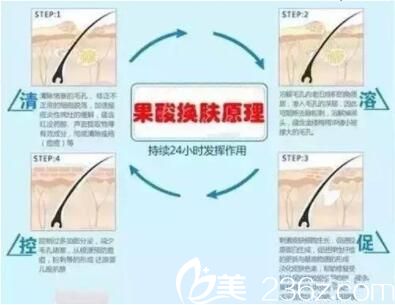 果酸换肤原理为什么会疼 果酸换肤原理为什么会疼