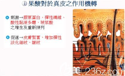 果酸换肤作用 果酸换肤作用