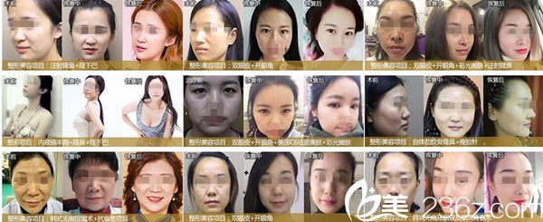 宜昌前卫整形案例合集