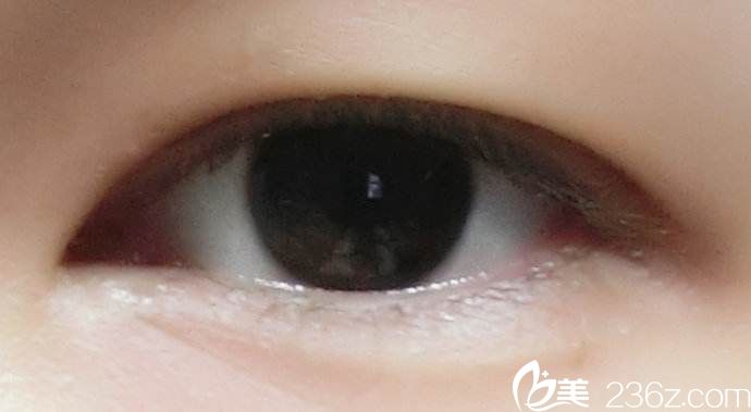 内双也有自己的烦恼