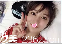 在北京联合丽格做弦性面部提升第7天效果