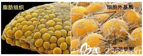 脂肪胶和普通脂肪的区别