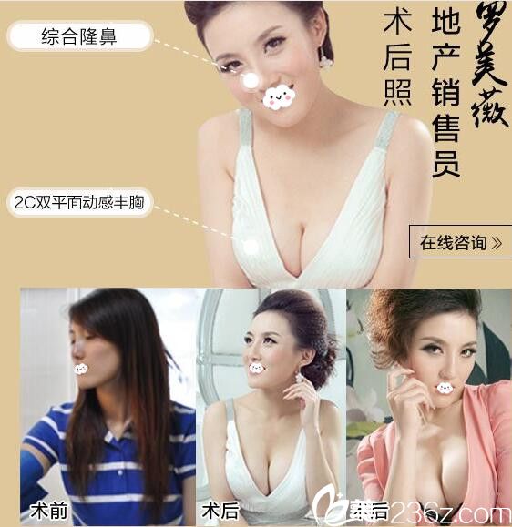 淮北微悦医疗美容门诊部假体鼻综合、隆胸效果怎么样 淮北微悦医疗美容门诊部假体鼻综合、隆胸效果怎么样