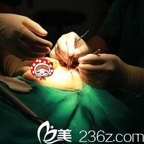 内切祛眼袋手术过程中