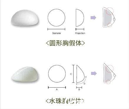 丰胸假体也分不同的形状