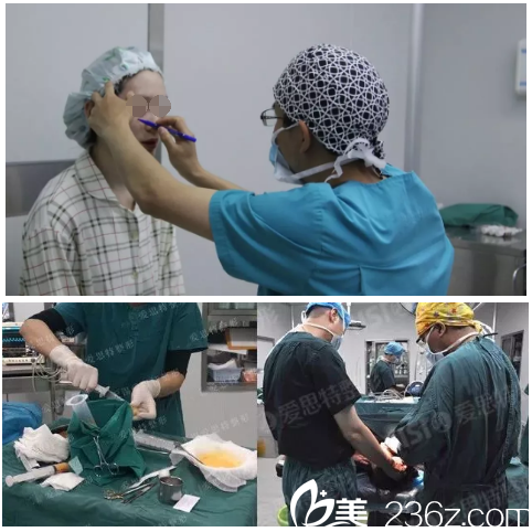 自体脂肪填充手术中 自体脂肪填充手术中