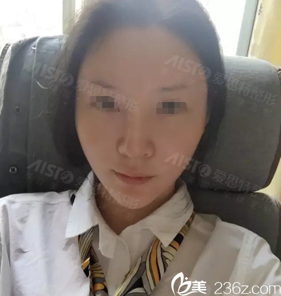 脂肪填充术后三天恢复 脂肪填充术后三天恢复