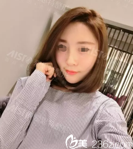 五天后自体脂肪填充恢复 五天后自体脂肪填充恢复