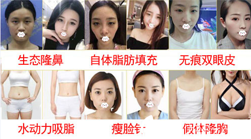 淮北东方美莱坞(伊尔美)医疗美容医院双眼皮、隆鼻、隆胸案例